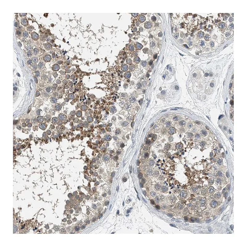 Atlas Antibodies Anti-TTBK2 Antibody