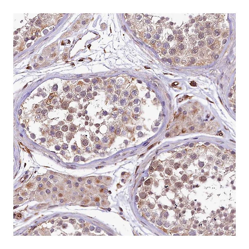 Atlas Antibodies Anti-TTC12 Antibody