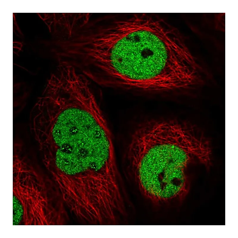 Atlas Antibodies Anti-TTC13 Antibody