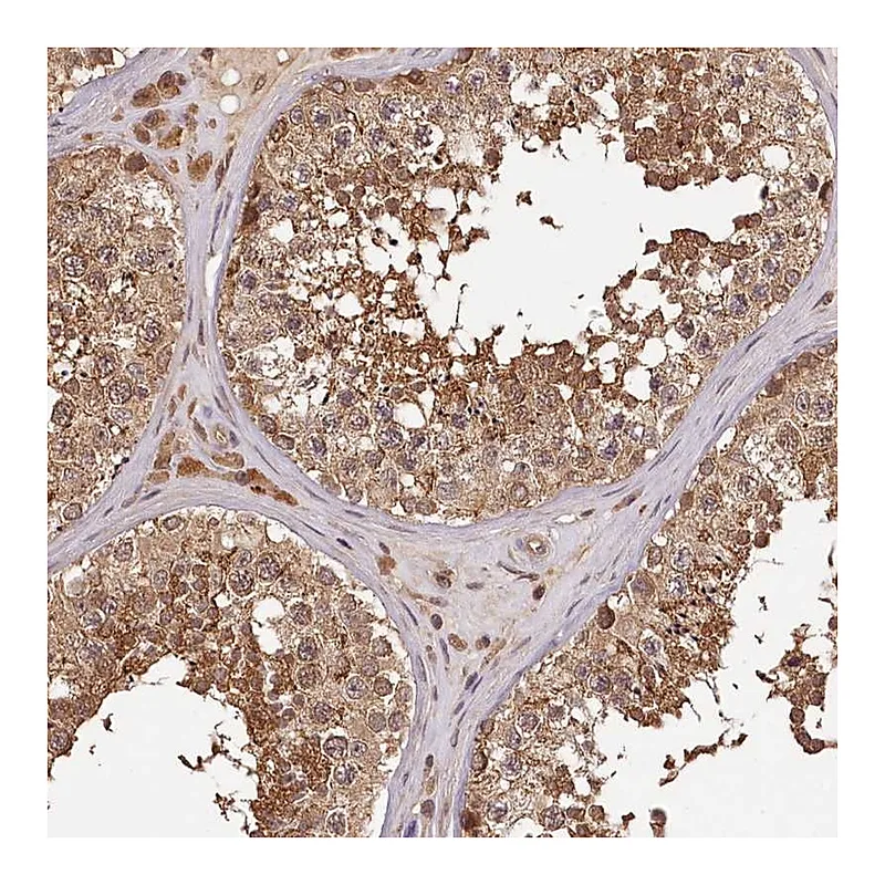Atlas Antibodies Anti-TTC12 Antibody