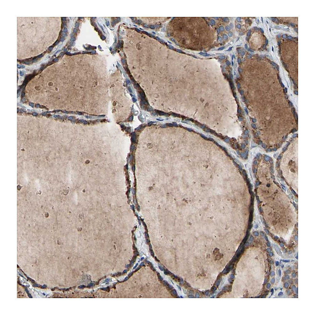 Atlas Antibodies Anti-TTC14 Antibody