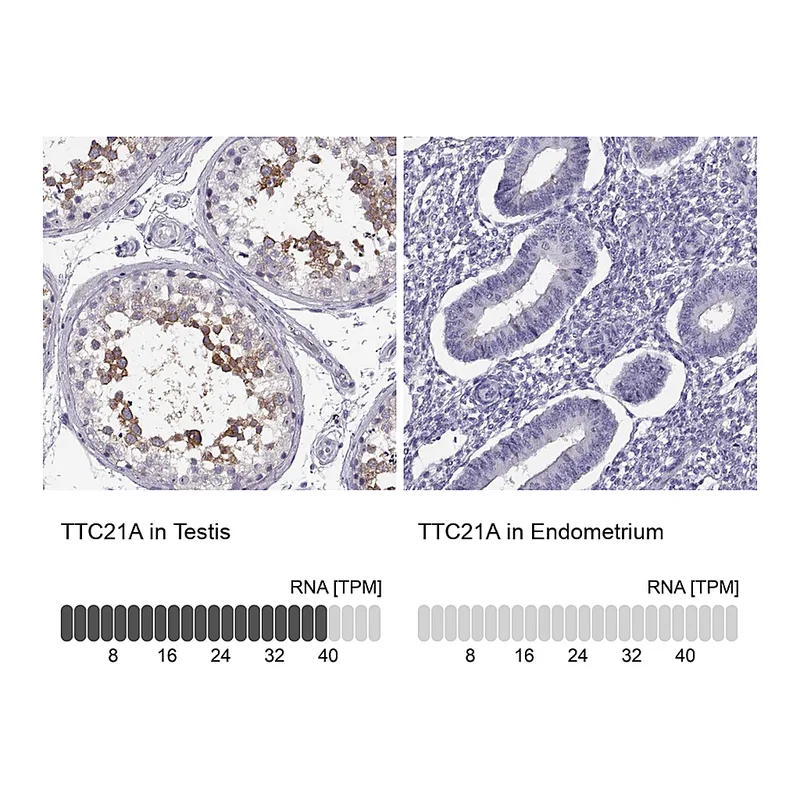 Atlas Antibodies Anti-TTC21A Antibody