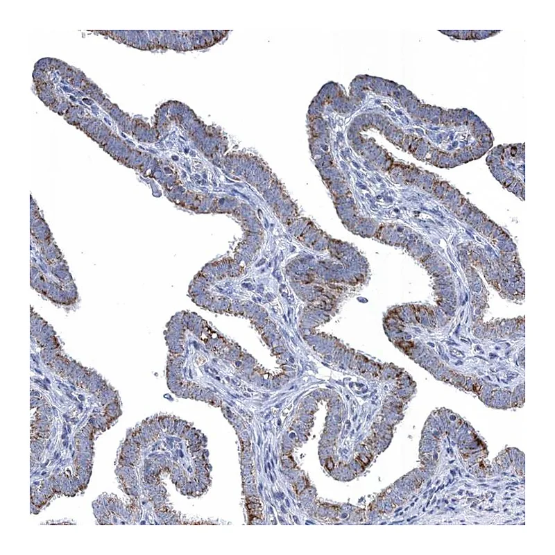 Atlas Antibodies Anti-TTC21B Antibody