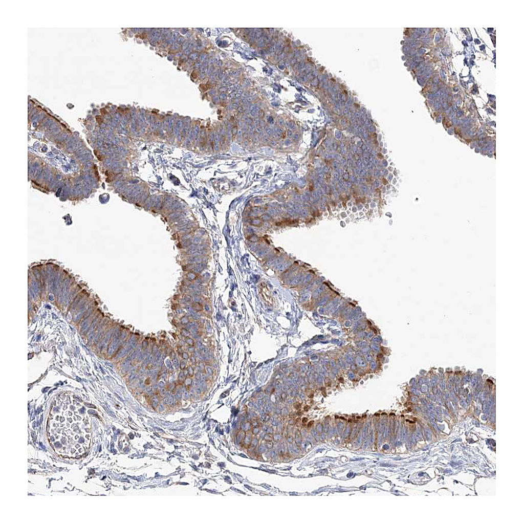 Atlas Antibodies Anti-TTC21B Antibody