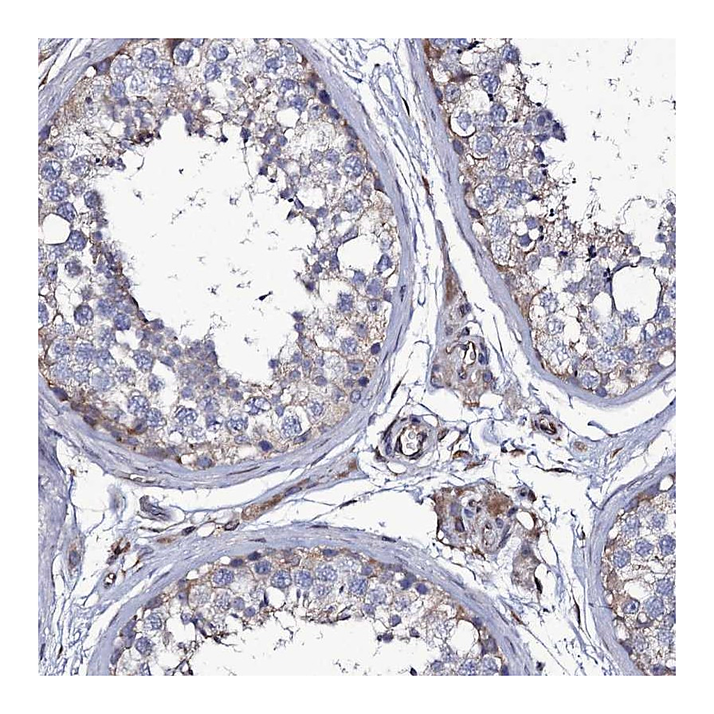 Atlas Antibodies Anti-TTC23 Antibody