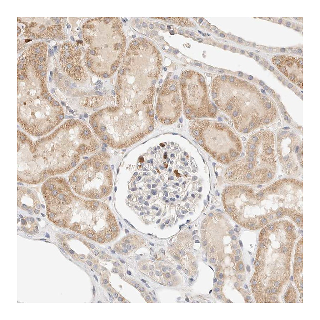 Atlas Antibodies Anti-TTC3 Antibody