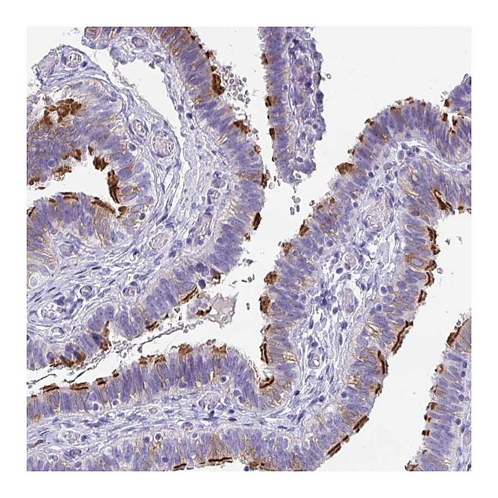 Atlas Antibodies Anti-TTC30A Antibody