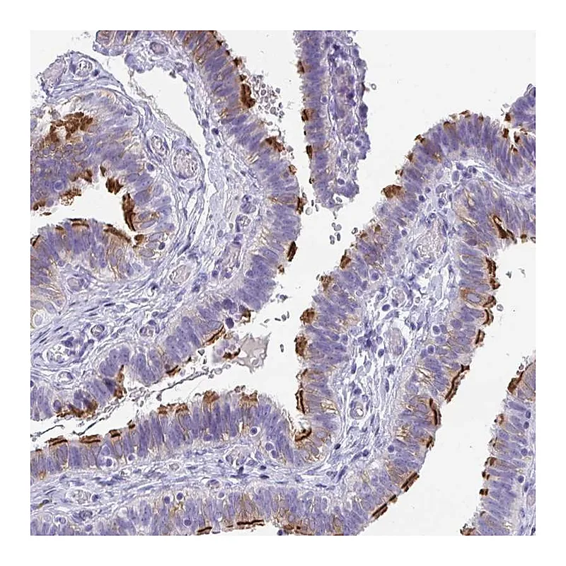 Atlas Antibodies Anti-TTC30A Antibody