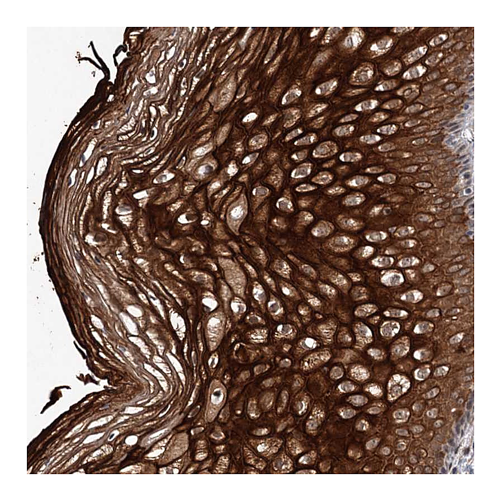 Atlas Antibodies Anti-TTC31 Antibody