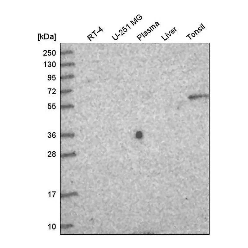 Atlas Antibodies Anti-TTC39A Antibody