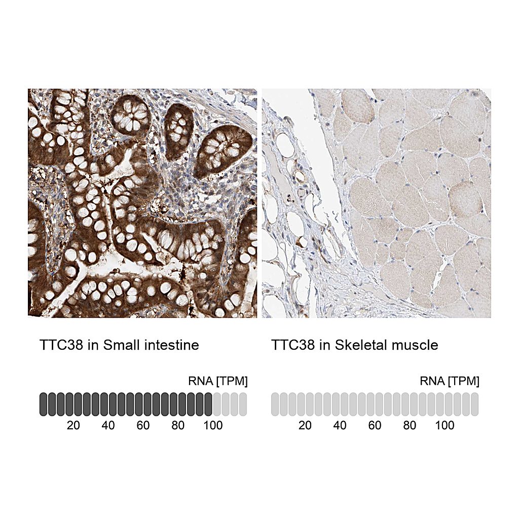 Atlas Antibodies Anti-TTC38 Antibody