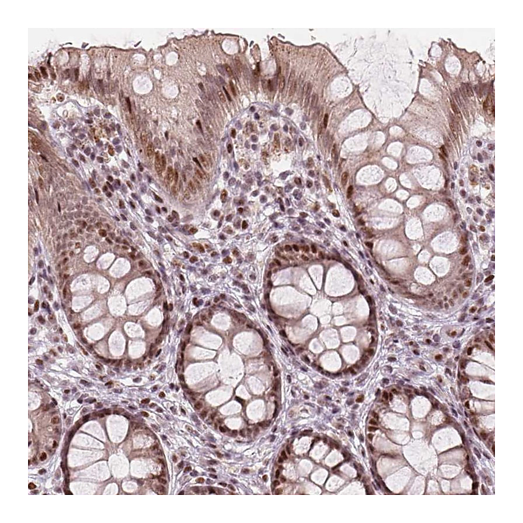 Atlas Antibodies Anti-TTC34 Antibody