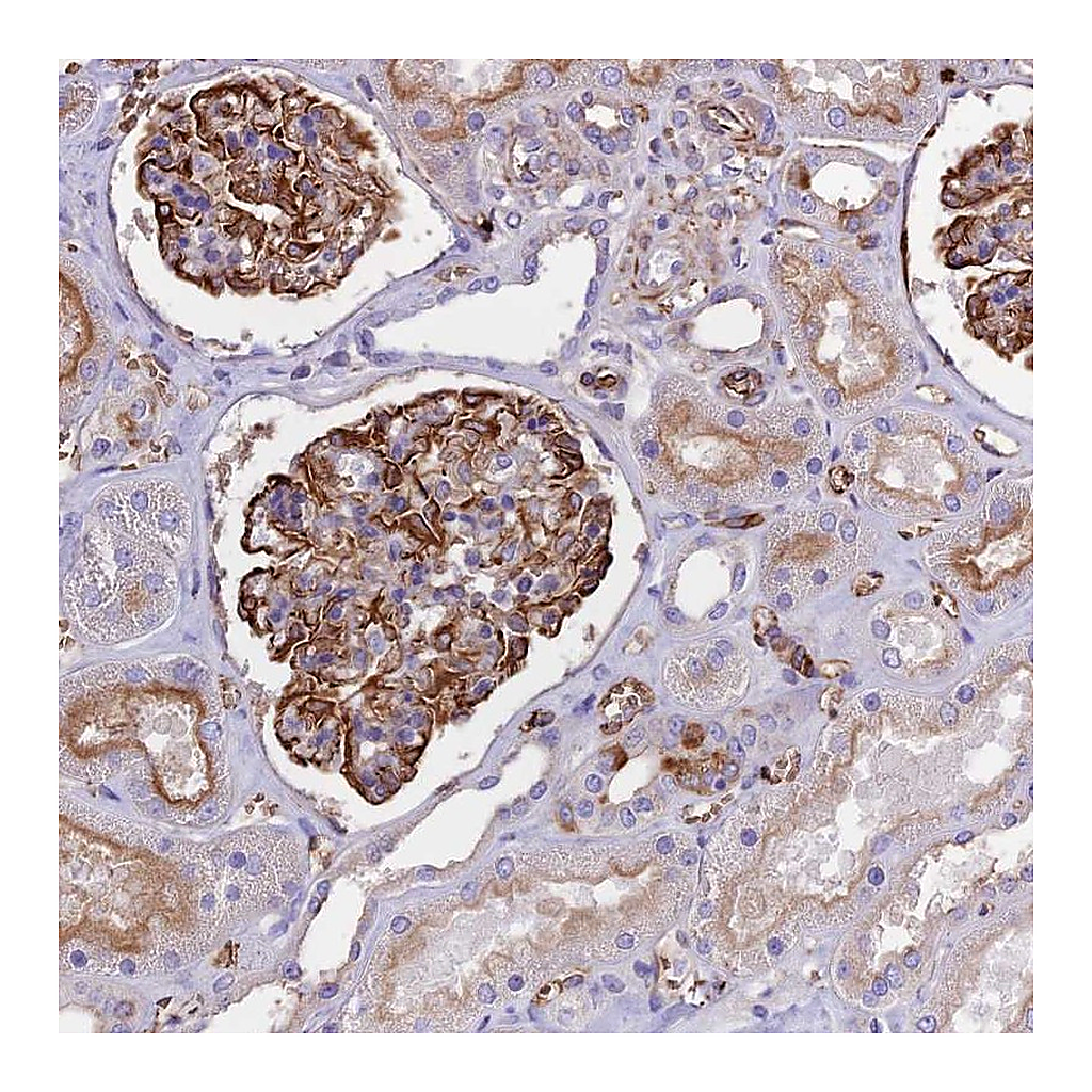 Atlas Antibodies Anti-TTC4 Antibody