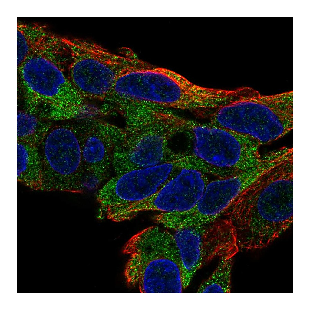 Atlas Antibodies Anti-TTC39B Antibody