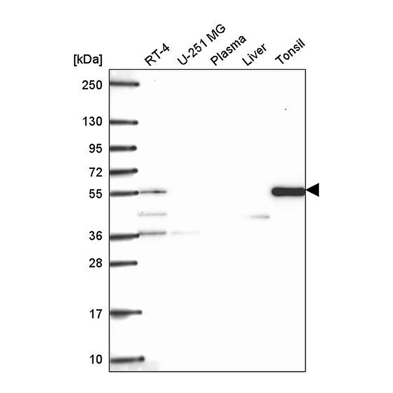 Atlas Antibodies Anti-TTC39C Antibody