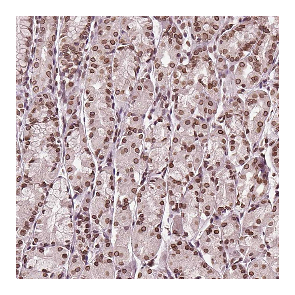 Atlas Antibodies Anti-TTC39C Antibody