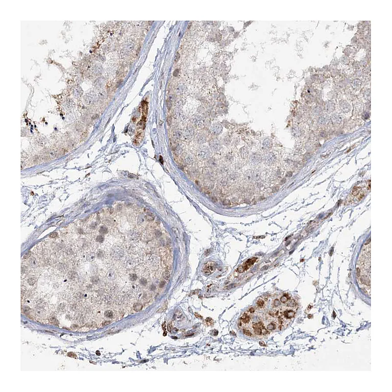 Atlas Antibodies Anti-TTC7A Antibody