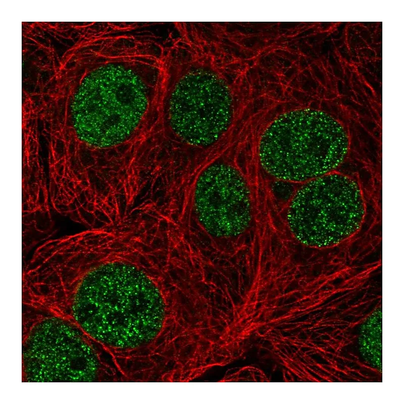 Atlas Antibodies Anti-TTC5 Antibody