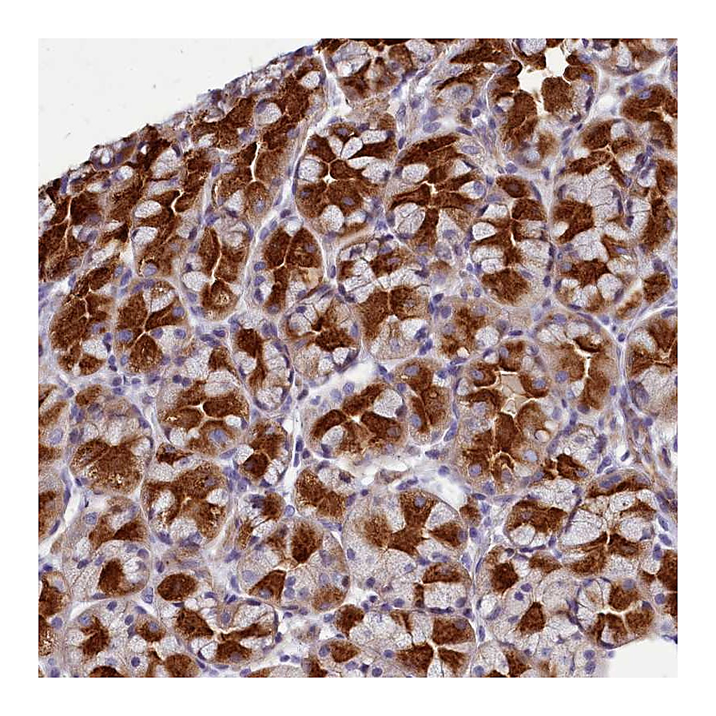 Atlas Antibodies Anti-TTC5 Antibody
