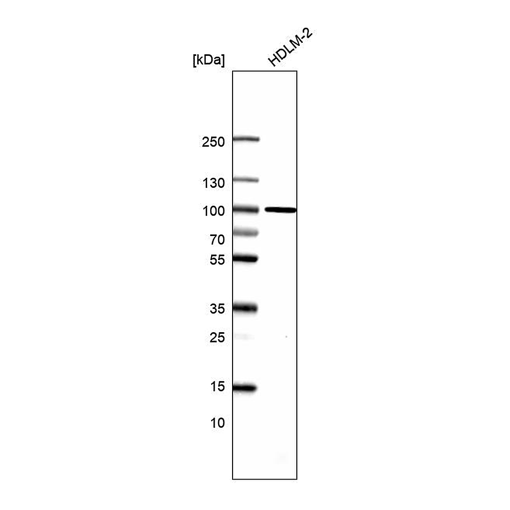 Atlas Antibodies Anti-TTC7B Antibody