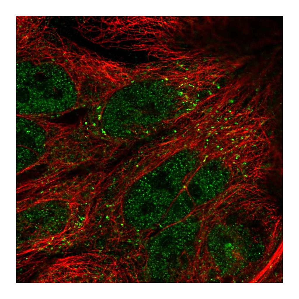 Atlas Antibodies Anti-TTI1 Antibody