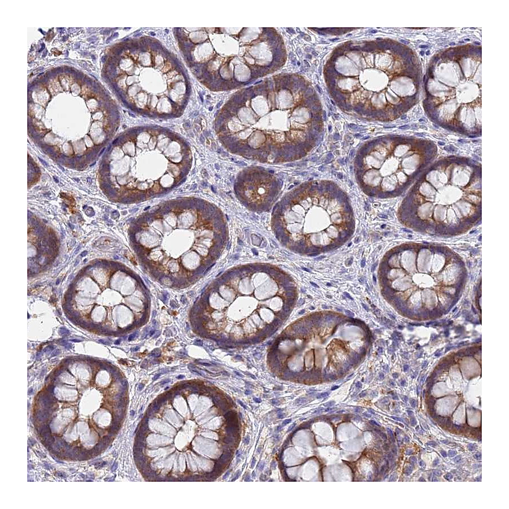 Atlas Antibodies Anti-TTLL11 Antibody