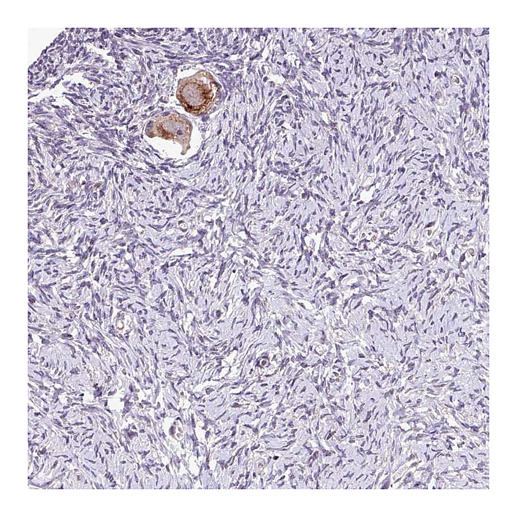 Atlas Antibodies Anti-TTLL3 Antibody