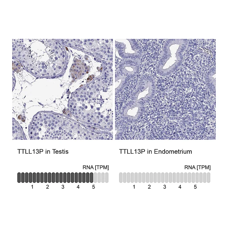 Atlas Antibodies Anti-TTLL13P Antibody