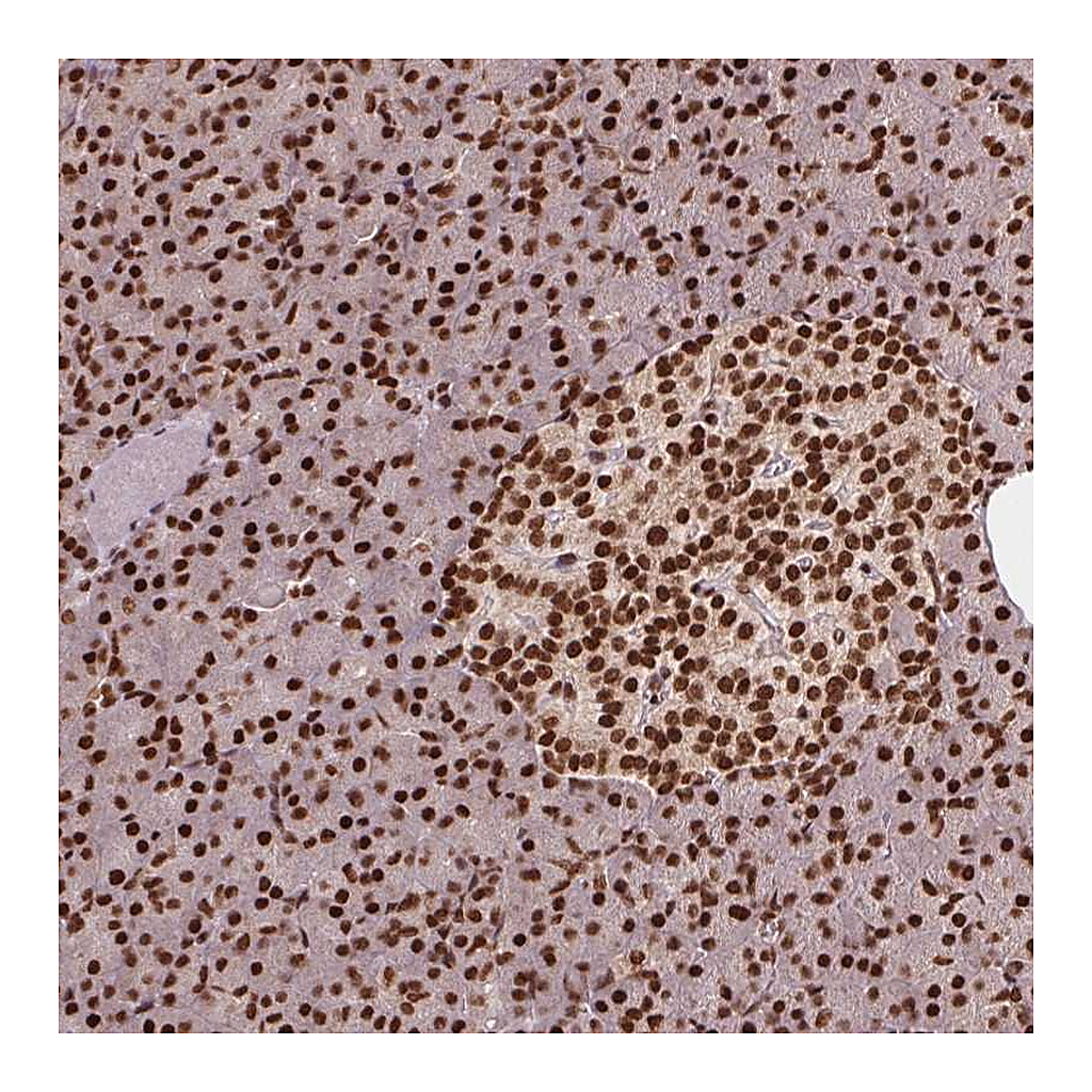Atlas Antibodies Anti-TTLL9 Antibody