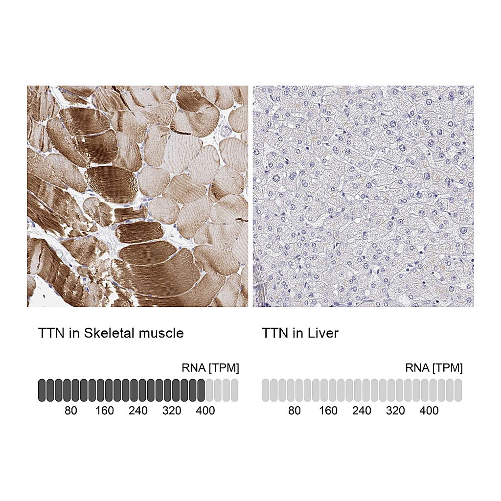 Atlas Antibodies Anti-TTN Antibody