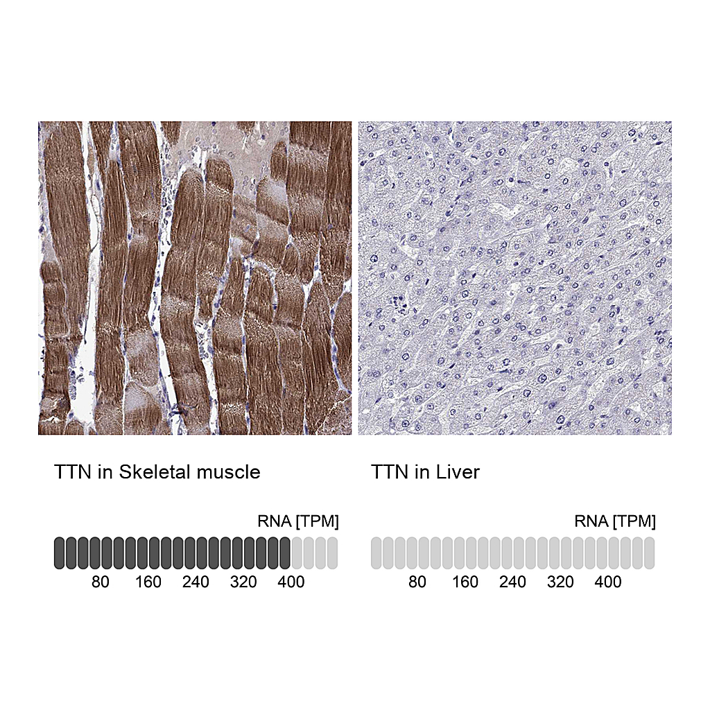 Atlas Antibodies Anti-TTN Antibody