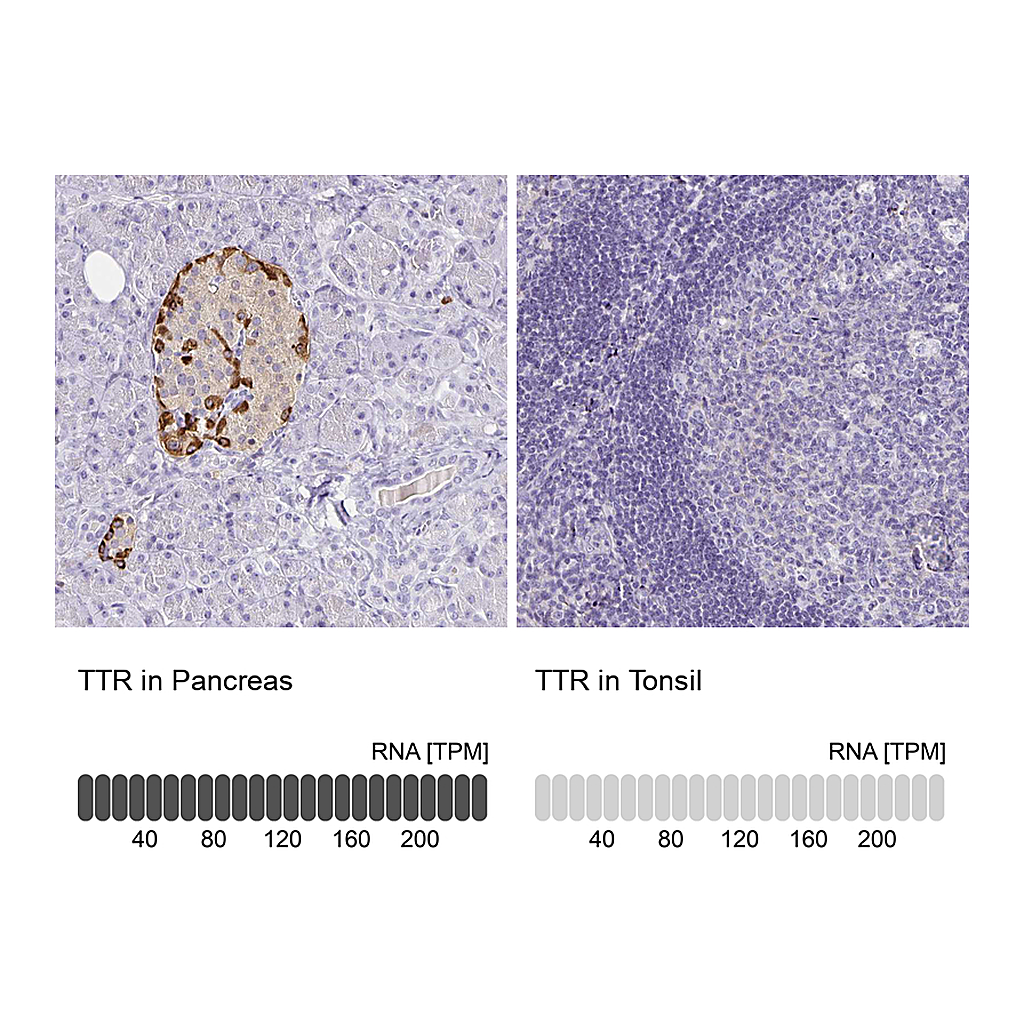 Atlas Antibodies Anti-TTR Antibody