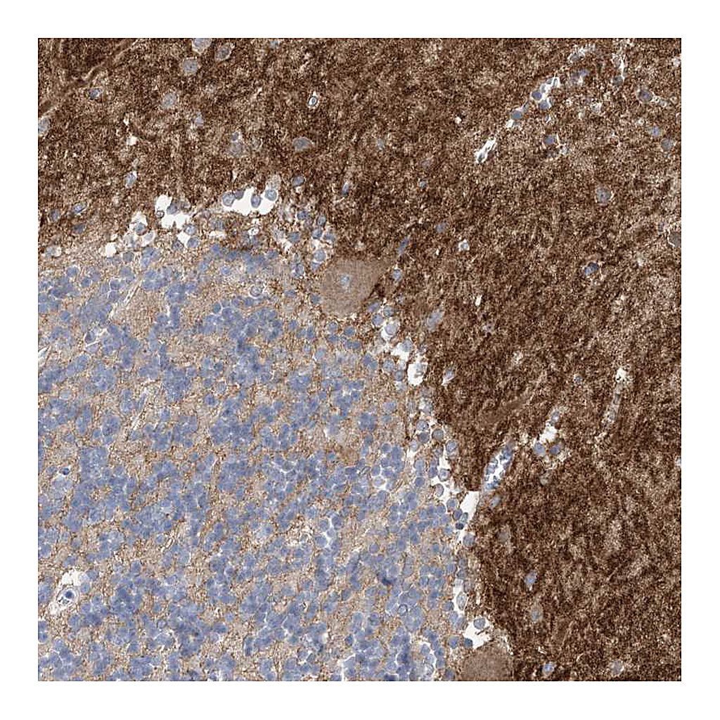 Atlas Antibodies Anti-TTYH1 Antibody