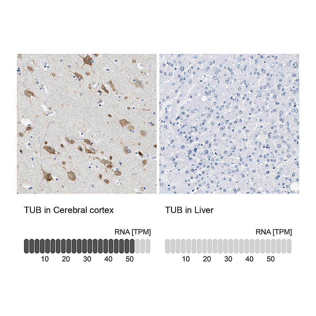 Atlas Antibodies Anti-TUB Antibody