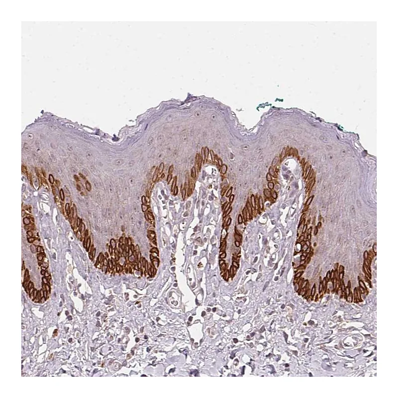 Atlas Antibodies Anti-TUB Antibody