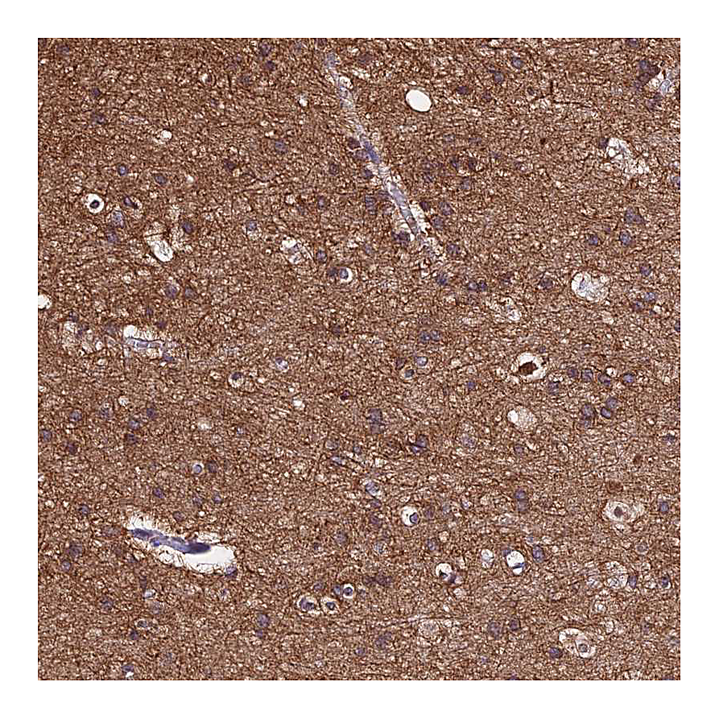 Atlas Antibodies Anti-TUBA1A Antibody