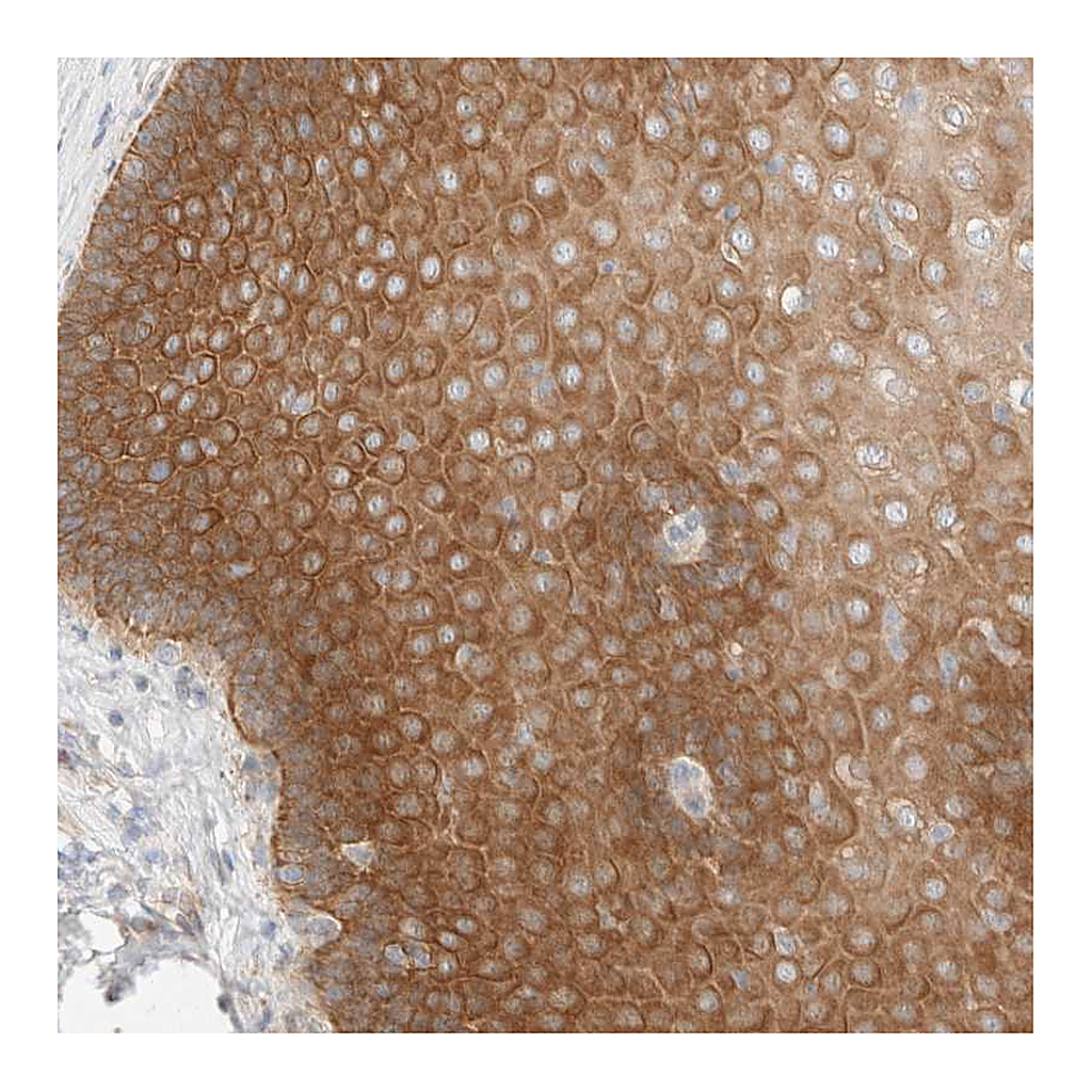 Atlas Antibodies Anti-TUBD1 Antibody