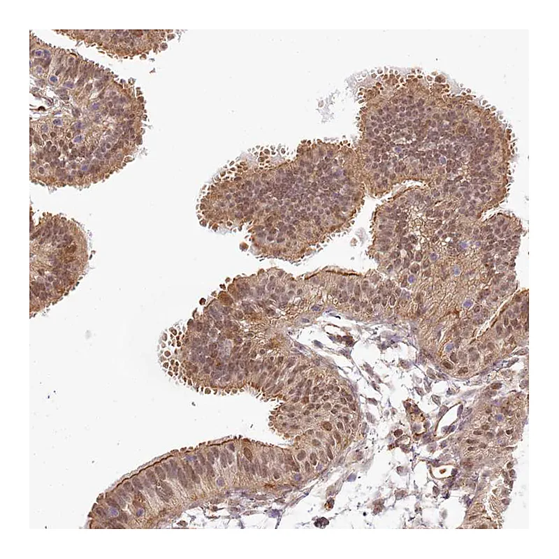 Atlas Antibodies Anti-TUBGCP2 Antibody