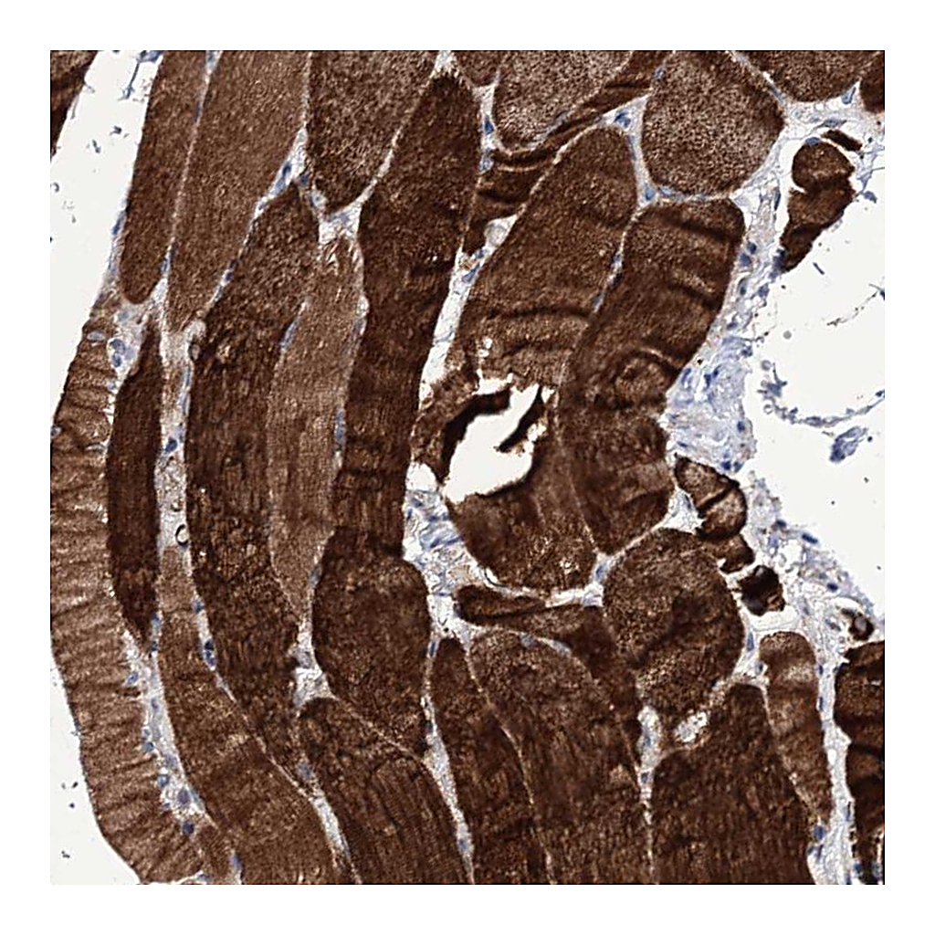 Atlas Antibodies Anti-TUBGCP5 Antibody