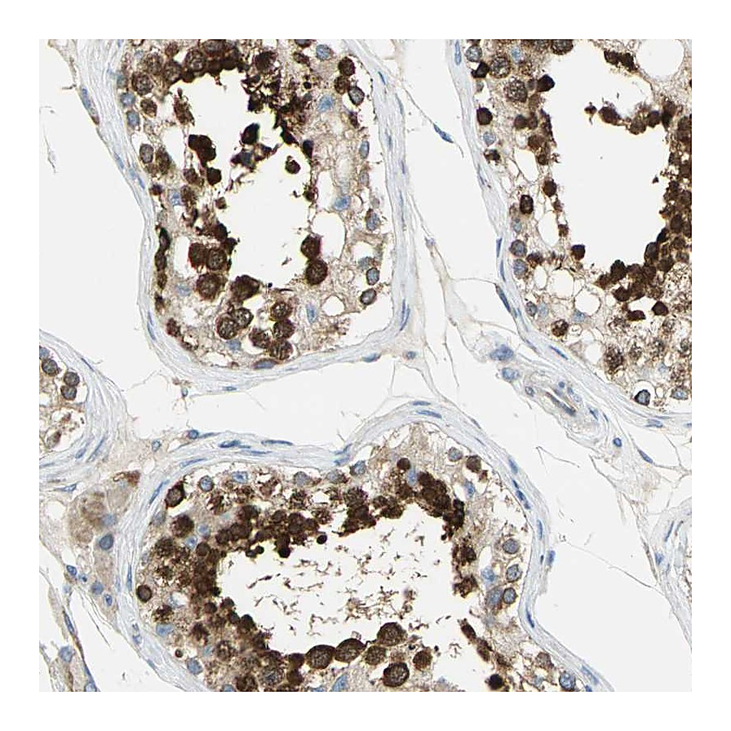Atlas Antibodies Anti-TULP4 Antibody