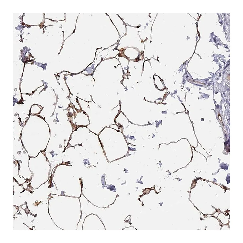 Atlas Antibodies Anti-TUSC5 Antibody