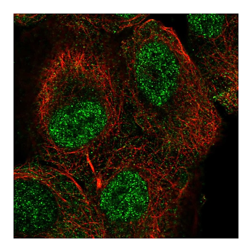 Atlas Antibodies Anti-TUT1 Antibody