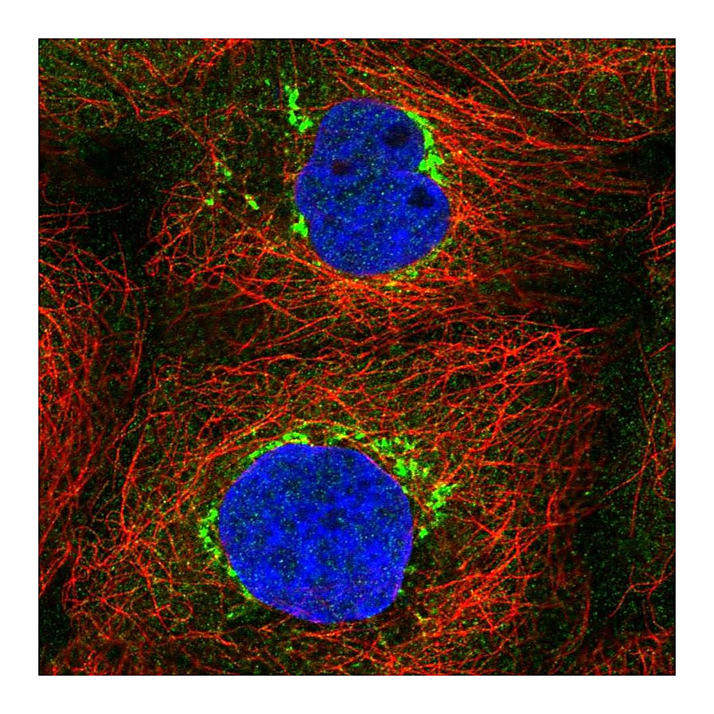 Atlas Antibodies Anti-TVP23C Antibody
