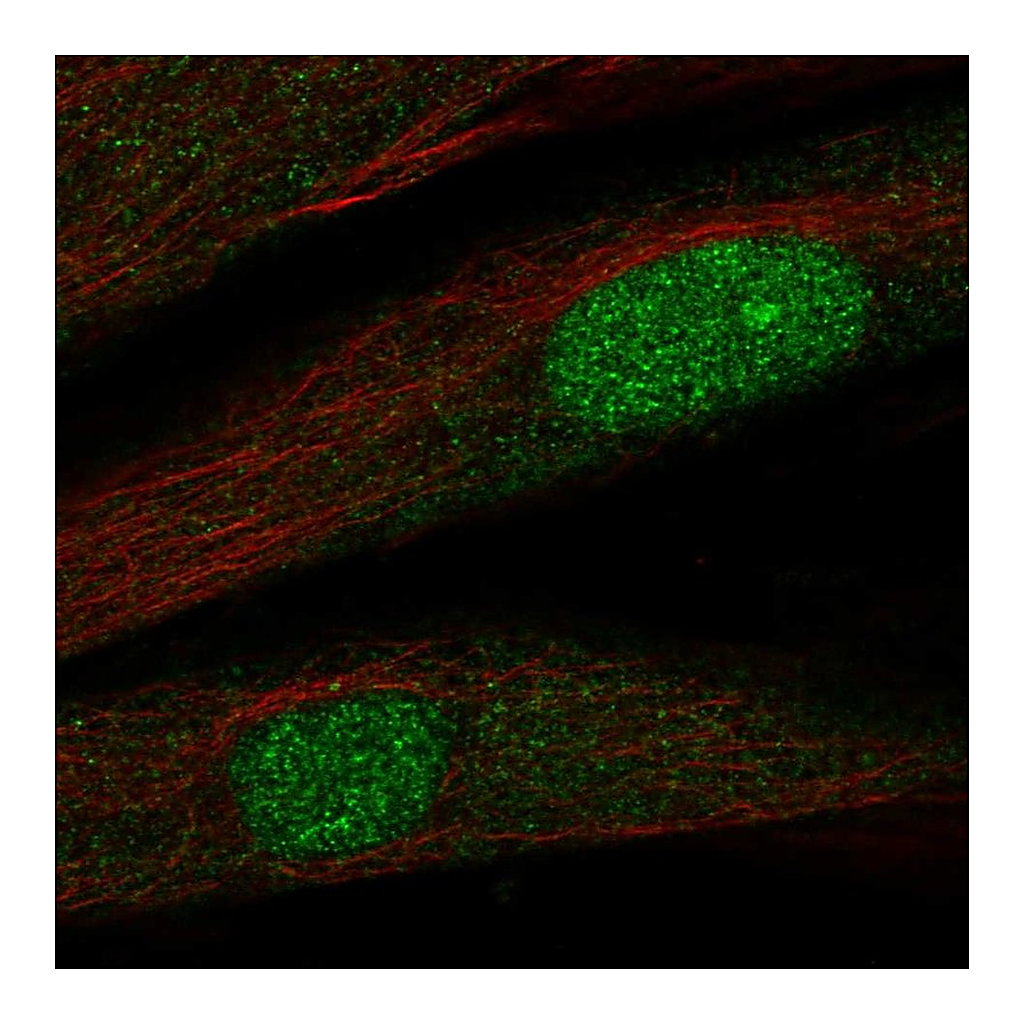 Atlas Antibodies Anti-TWIST2 Antibody