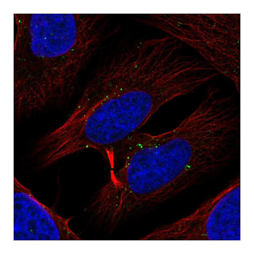 Atlas Antibodies Anti-TXK Antibody
