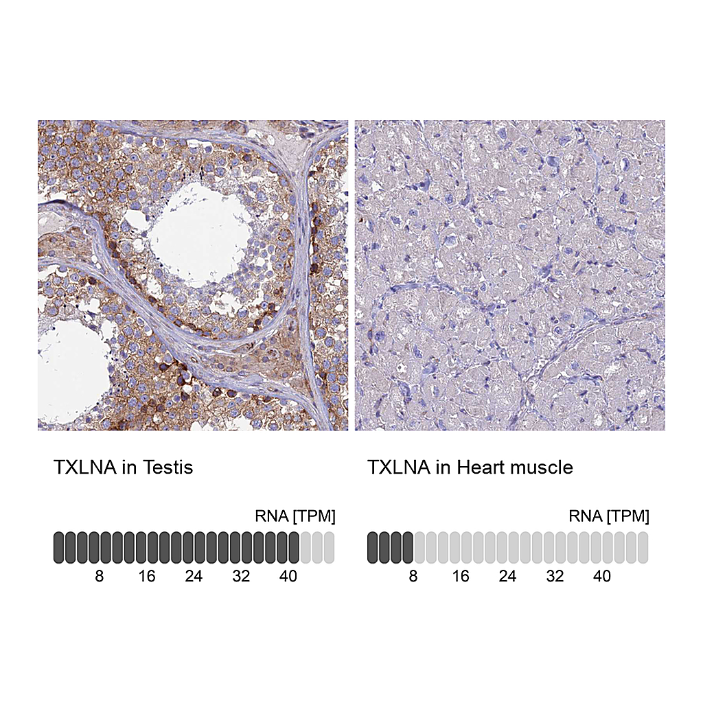 Atlas Antibodies Anti-TXLNA Antibody