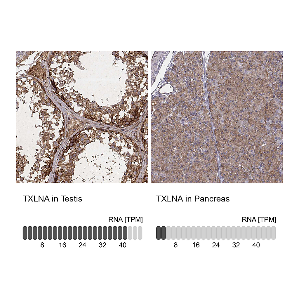 Atlas Antibodies Anti-TXLNA Antibody