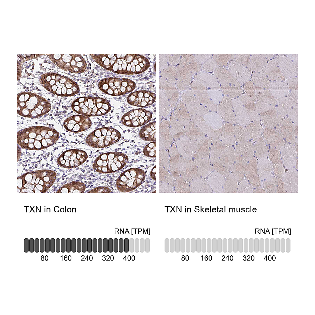 Atlas Antibodies Anti-TXN Antibody