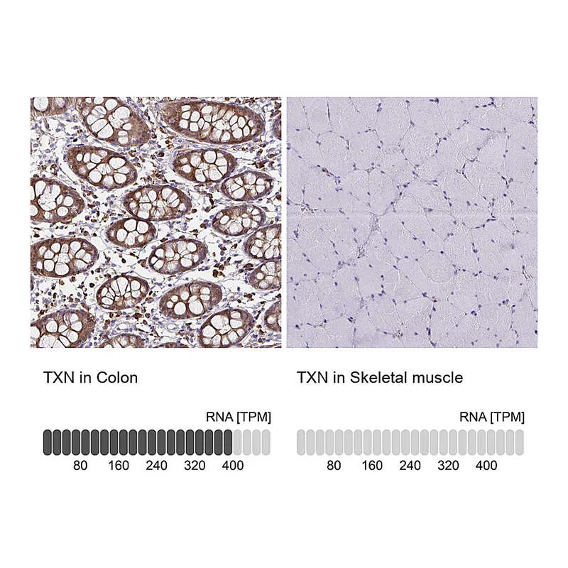 Atlas Antibodies Anti-TXN Antibody