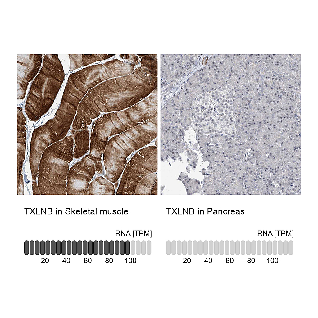 Atlas Antibodies Anti-TXLNB Antibody